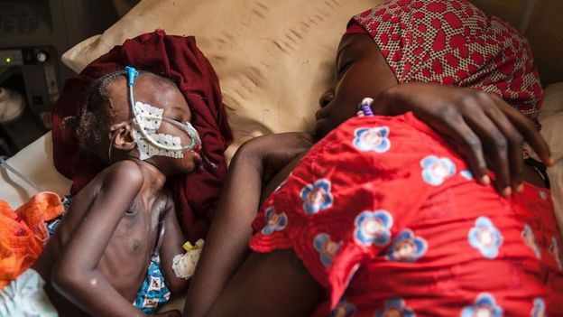 Niño con su madre en una clínica de Maiduguri