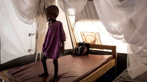 أحد الأطفال المشردين بسبب الصراع بوسط الكونغو