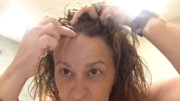 Nadia Sawalha en el video en el que habla sobre su alopecia.