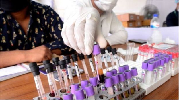 বাংলাদেশে নমুনা পরীক্ষার হার কম হওয়ায় উদ্বেগ রয়েছে।