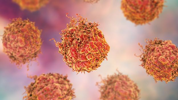 Células cancerígenas del cáncer de próstata.