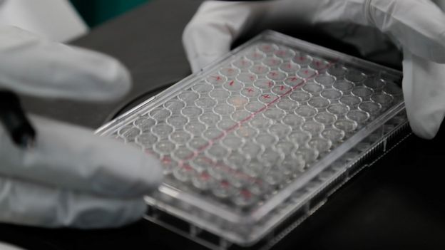 Pruebas de laboratorio en Rusia para encontrar una vacuna contra el coronaviurs