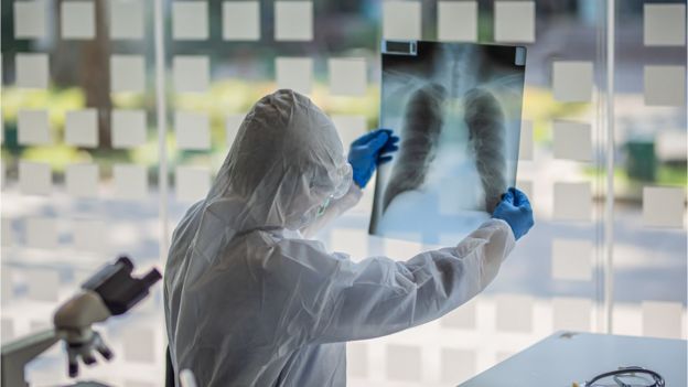 Especialista analisando radiografia de um pulmão