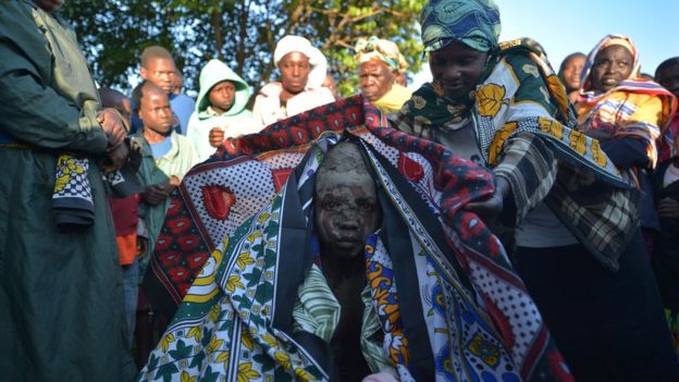 Tohara ya Wanaume inaweza kuzuia 200,000 kupata Ukimwi Tanzania