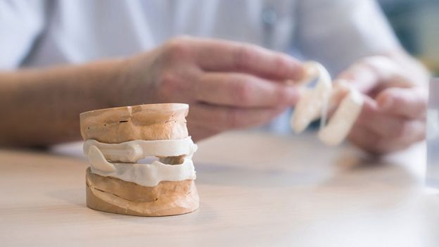 Mandibular advancement braces being handled by an ENT surgeon