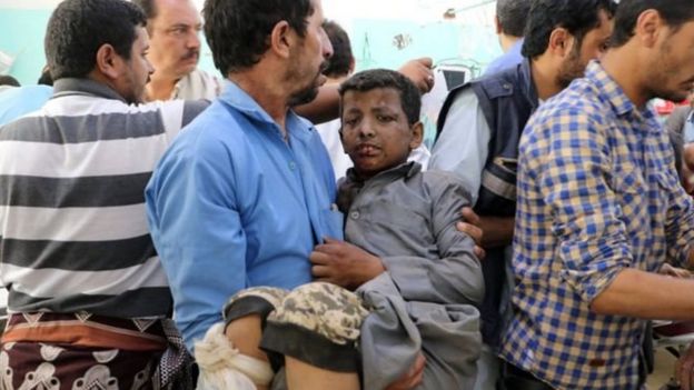 ஏமன் போர்: சௌதி கூட்டணியின் வான் தாக்குதலில் 43 பேர் உயிரிழப்பு