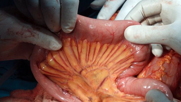  un doble pliegue del peritoneo