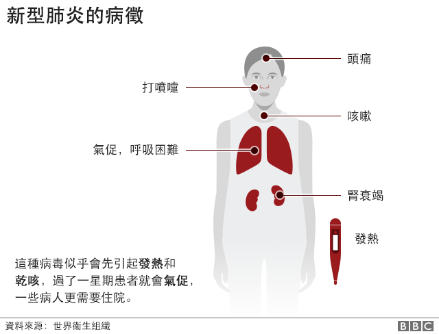 示意圖