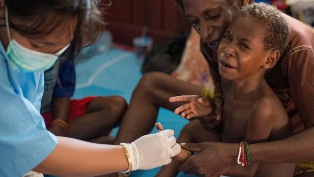 Criança doente é atendida por equipe de saúde