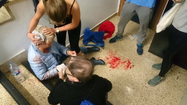 A woman sits injured on a staircase as another person covers her head partially with a cloth, in Barcelona, Spain October 1, 2017