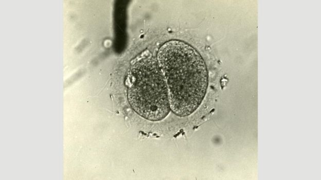 En 1944 se produjo la primera fertilización exitosa de un óvulo fuera del organismo.