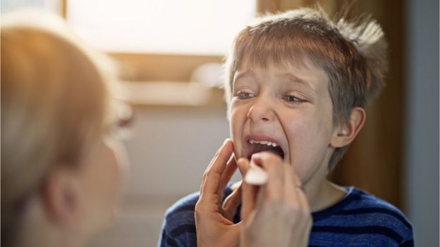   Child opening mouth to show throat to doctor 