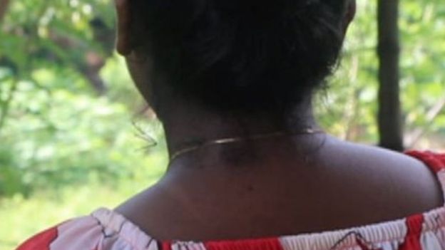 Shiroma Pereira de costas - é possível ver pequenas manchas escuras no seu pescoço