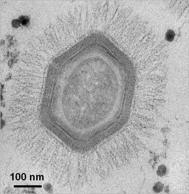 Imagen microscópica de mimivirus