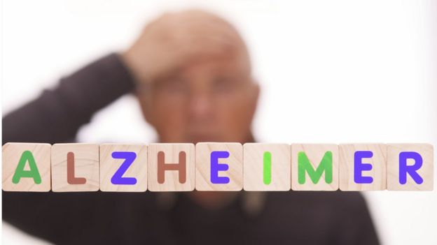 La sorprendente relación entre el herpes labial y el alzhéimer (y qué implica para tratar esta enfermedad mental) _104005312_gettyimages-169372694