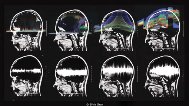 Serie de escaneos cerebrales. Foto: Silvia Grav.