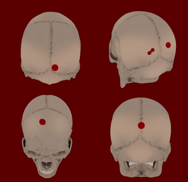 Diagramación de los cráneos encontrados con puntos que señalan los orificios