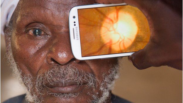 escaneo de un ojo con un celular