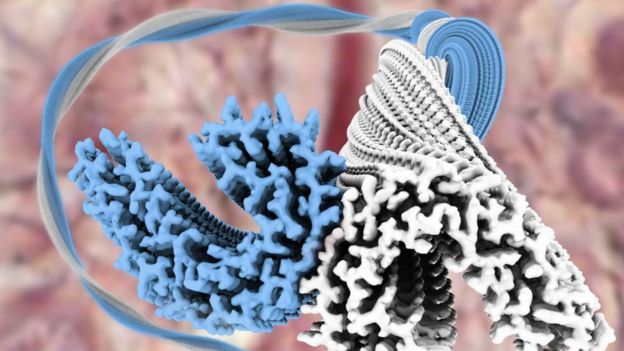 التصوير الدقيق لدماغ مصابي الزهايمر يساهم في التوصل للعلاج