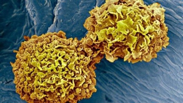 क्यान्सर