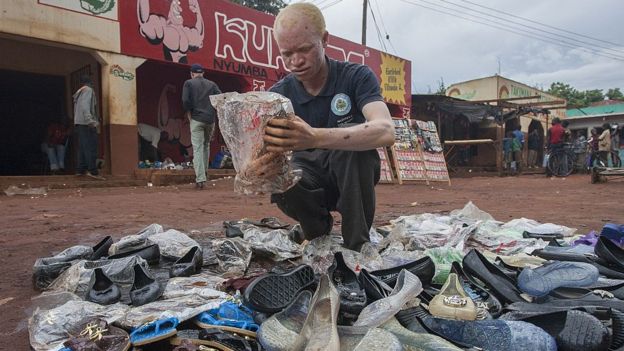 Jammtain Frenando, un albinos malawite vendeur de chaussures en 2015 à Lilongwe. (Illustration)