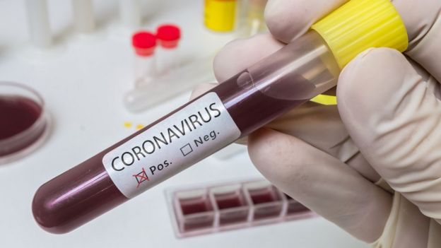 Exame de coronavirus - ILUSTRAÇÃO