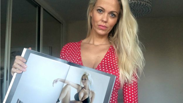 Malene before and after her breast implants