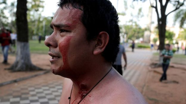 Un manifestante con sangre