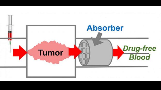 Graphic of how the device works