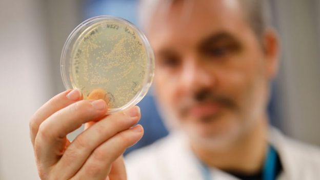 Un médico británico sostiene una placa Petri con bacteria infectada de coronavirus