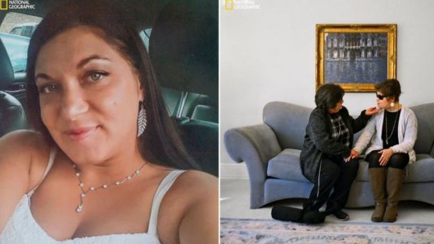 Katie, bağışçı Adrea Schneider'ın (solda) anneannesi (sağda) ile ameliyat sonrası bir araya geldi.