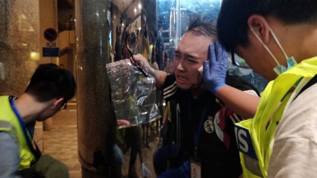 Andrew Chiu Ka Yin, District Councillor of Taikoo Shing West, receives help from first aid volunteers after sustaining an injury in a knife attack at a shopping mall, in Taikoo Shing in Hong Kong, China November 3, 2019.