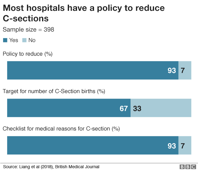 C-section policies in hospitals