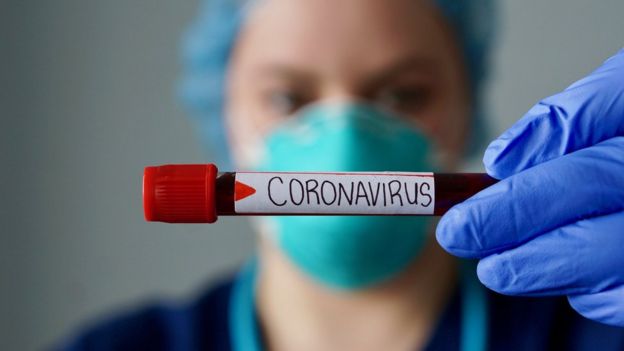 Médico com máscara segurando tubo de exame de coronavírus