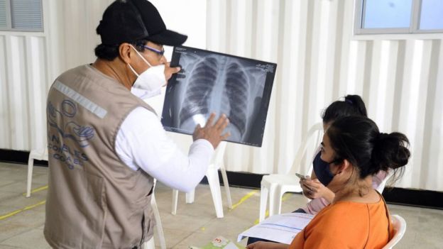 Hombre muestra una placa del tórax a una mujer en Bolivia.