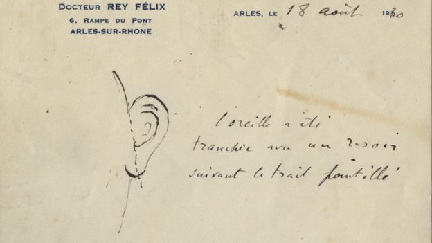 Image result for van gogh ear