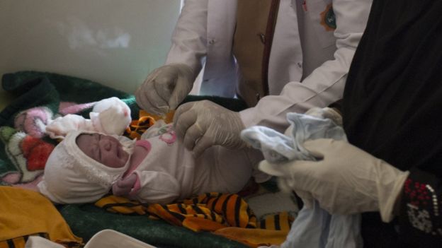 The UNFPA medical team tend a baby born in their delivery room