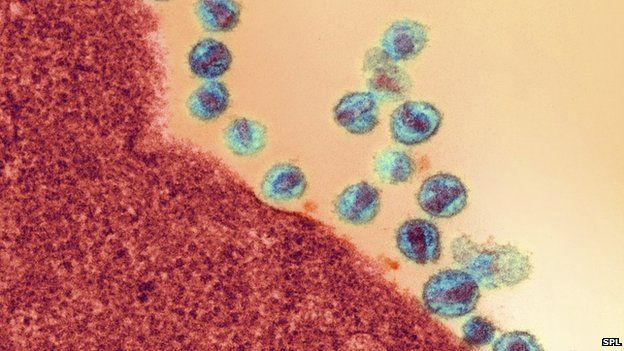 Hiv Flushed Out By Cancer Drug Bbc News 