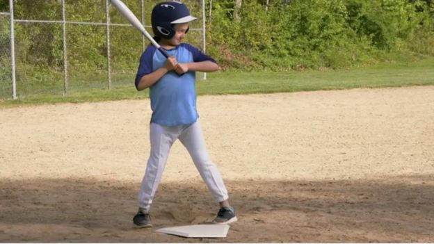 Girl playing baseball, fixed