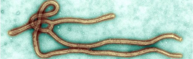 The Ebola virus