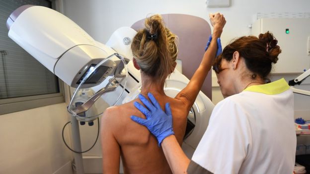 Институт Паоли-Кальмет во Франции. Женщина проходит маммографию. Октябрь 2017 года.