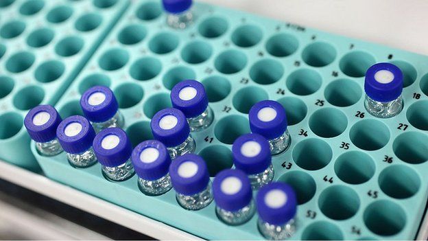 A tray of samples in an anti-doping laboratory