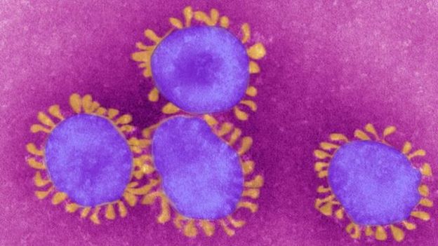Coronavirus Questions and answers