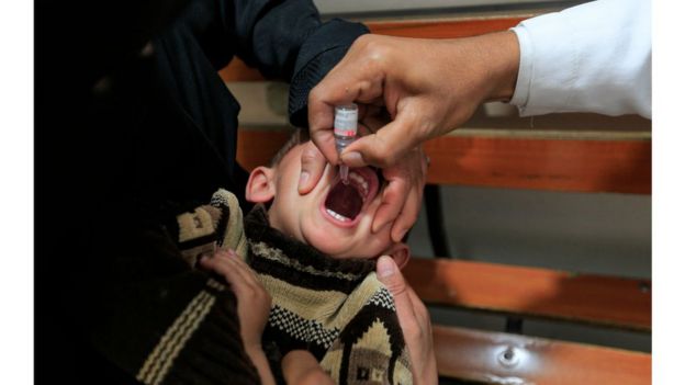 Vacina contra polio é dada à criança