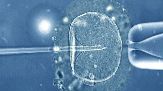 A human egg injected with a micro-needle that contains a single sperm