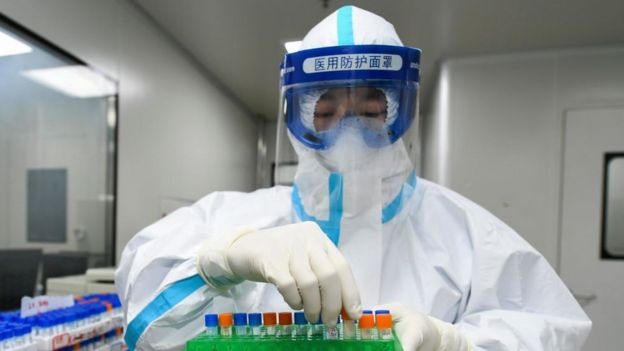 A medical worker samples for nucleic acid test at Weishi Medical Laboratory o­n March 4, 2020