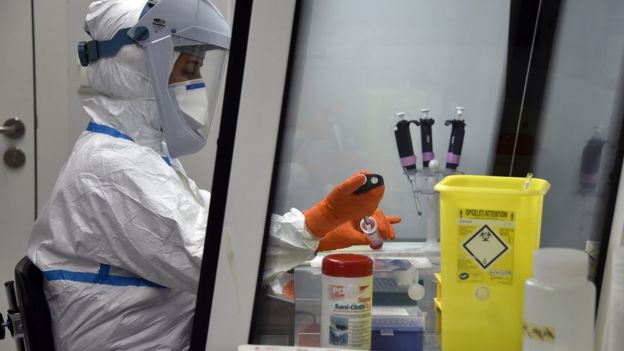 Cientista analisa amostra de sangue