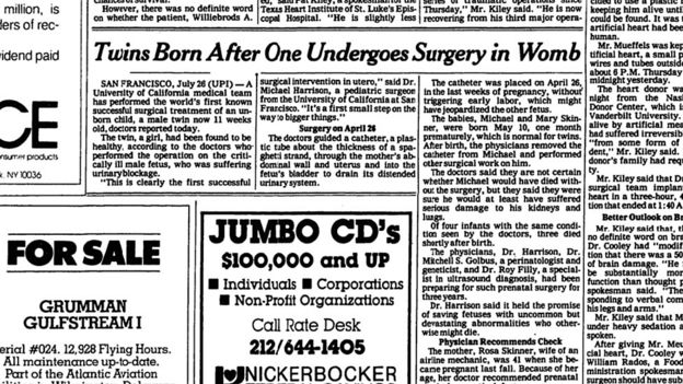La noticia sobre el nacimiento de los mellizos, en la página 8 del New York Times, del 27 de julio de 1981.