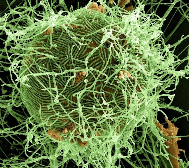 Virusi vya Ebola katika seli iliyoathirika