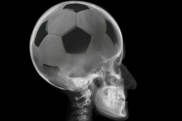 Imagen de una pelota como si fuese el cerebro de una persona.